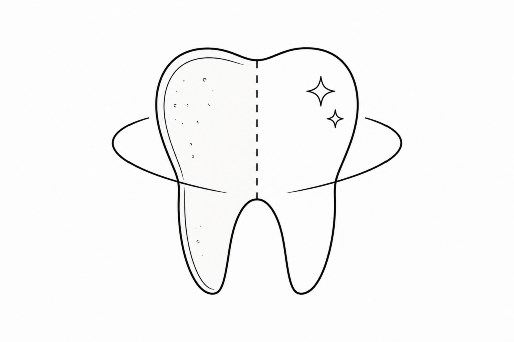 Blanqueamiento dental