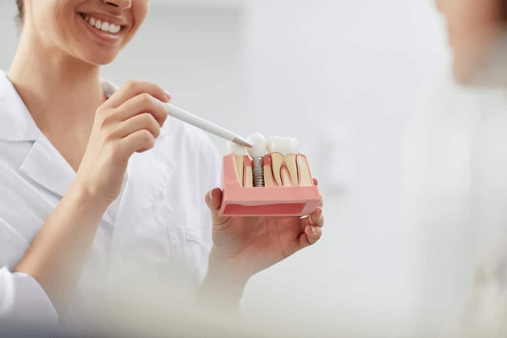 implante dental recuperacion